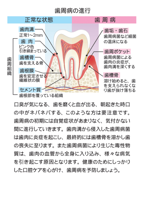 デンタルポリスDX 薬用ハミガキ【80g】（医薬部外品）